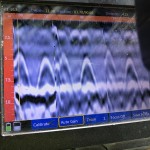 Test for Structural Integrity Before New Construction on Existing Foundation in Brooklyn, NY