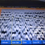 Detecting All "Delamination" and Voids in the Concrete Slabs and Structural Decks of the Building in Atlantic County, NJ